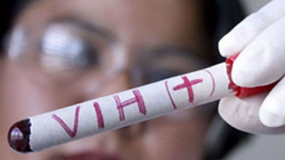 Más de 140 mil personas viven con VIH Sida en la Argentina y no descendió la mortalidad